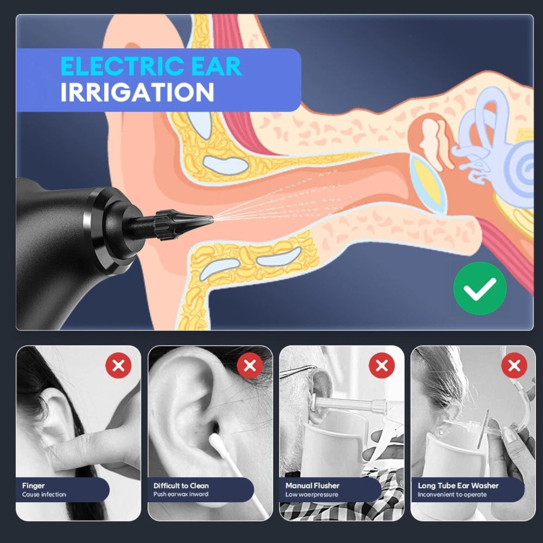 ClearTone™ - Ear Wax Remover