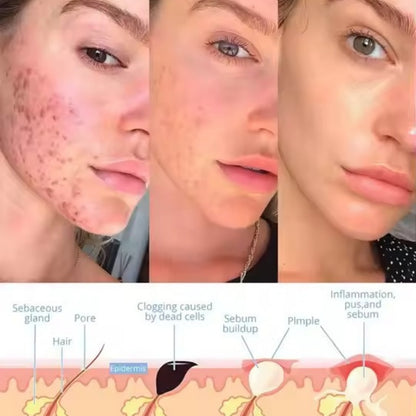 RadiantWave™ - Facial Wand