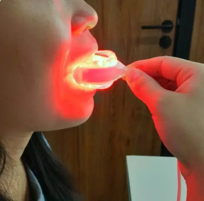 Smilara™ – LED Gum Therapy Device