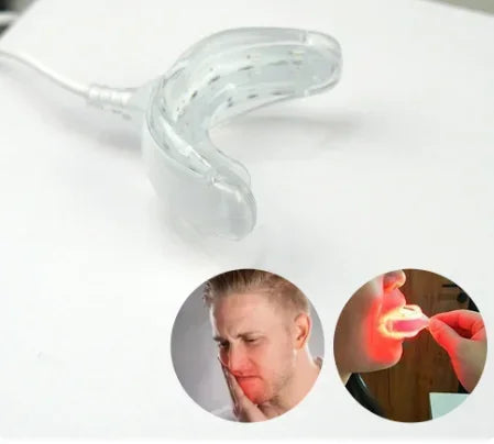 Smilara™ – LED Gum Therapy Device